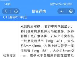 已经化疗4次，是否继续