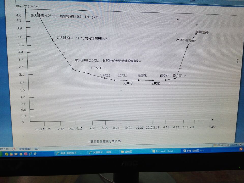 ct趋势