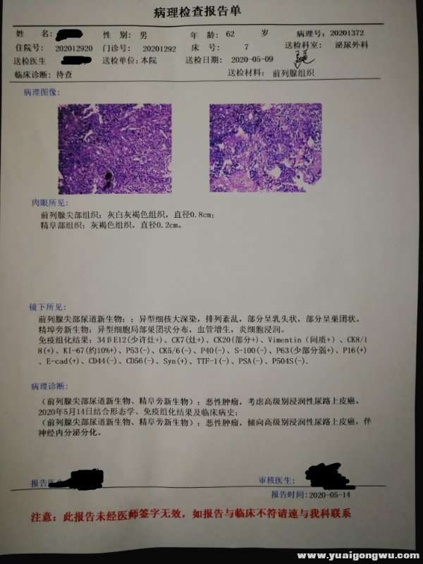 这是今天出的病理和免疫组化