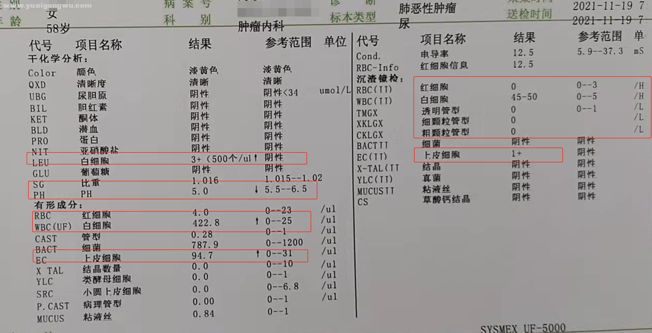 11月尿液